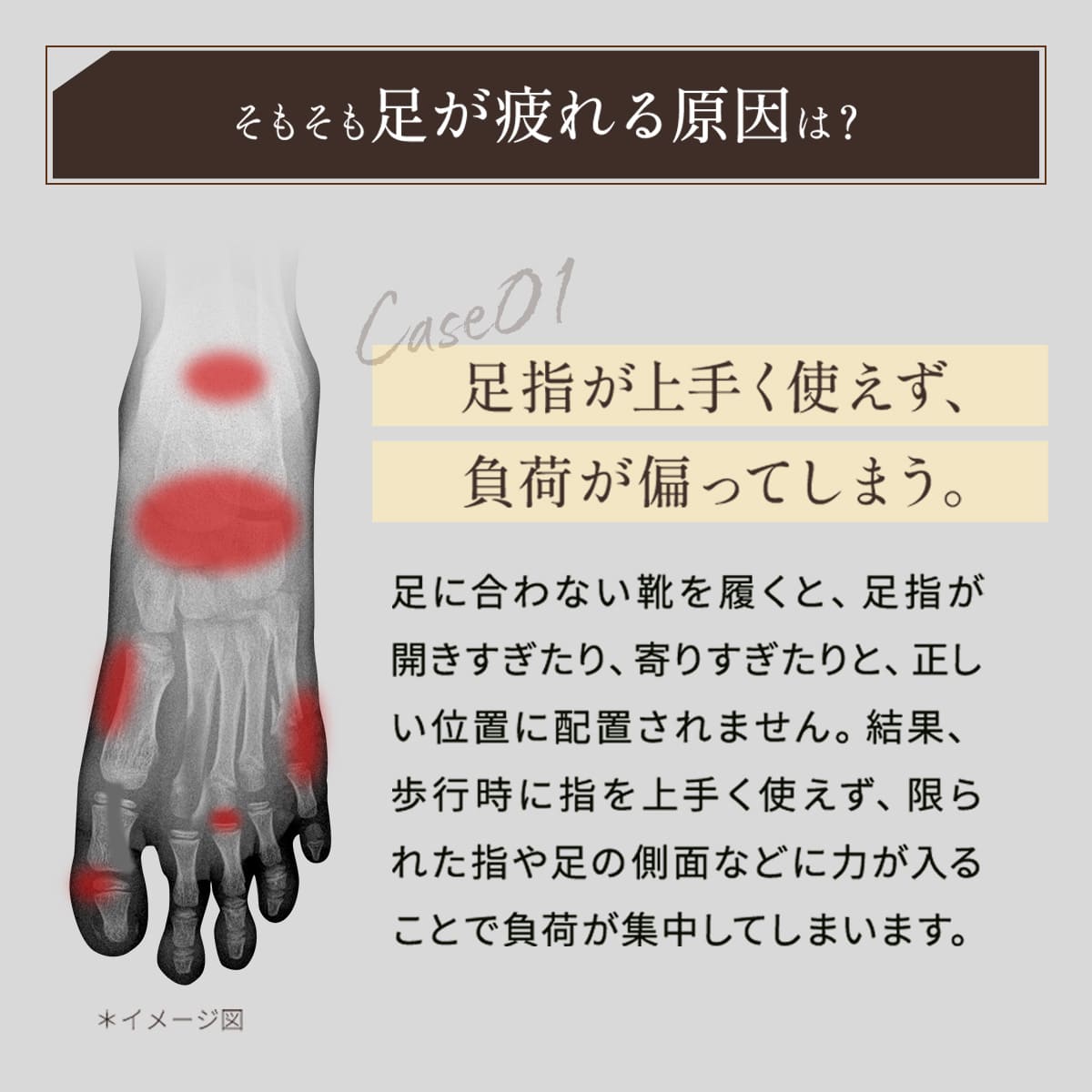 やみつきインソール モルフ│自分だけのインソールで快適ライフ